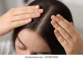 Sensitive Scalp